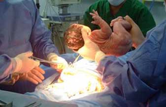 Thyrso Camargo Ayres Filho - Foto 1